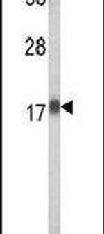 RPL31 Antibody in Western Blot (WB)
