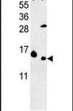 RPL37 Antibody in Western Blot (WB)