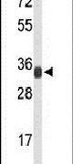 RPL5 Antibody in Western Blot (WB)