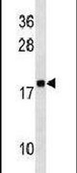 RPLP2 Antibody in Western Blot (WB)