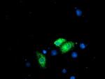 RPN1 Antibody in Immunocytochemistry (ICC/IF)