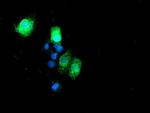 RPN1 Antibody in Immunocytochemistry (ICC/IF)