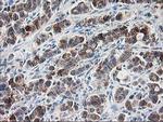 RPN1 Antibody in Immunohistochemistry (Paraffin) (IHC (P))