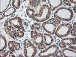 RPN1 Antibody in Immunohistochemistry (Paraffin) (IHC (P))
