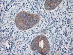 RPN1 Antibody in Immunohistochemistry (Paraffin) (IHC (P))