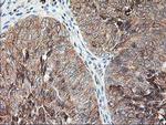 RPN1 Antibody in Immunohistochemistry (Paraffin) (IHC (P))