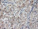 RPN1 Antibody in Immunohistochemistry (Paraffin) (IHC (P))