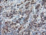 RPN1 Antibody in Immunohistochemistry (Paraffin) (IHC (P))