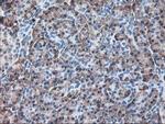 RPN1 Antibody in Immunohistochemistry (Paraffin) (IHC (P))