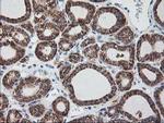 RPN1 Antibody in Immunohistochemistry (Paraffin) (IHC (P))