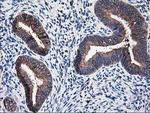 RPN1 Antibody in Immunohistochemistry (Paraffin) (IHC (P))