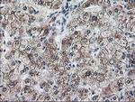 RPN1 Antibody in Immunohistochemistry (Paraffin) (IHC (P))