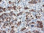 RPN1 Antibody in Immunohistochemistry (Paraffin) (IHC (P))