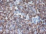 RPN1 Antibody in Immunohistochemistry (Paraffin) (IHC (P))