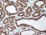 RPN1 Antibody in Immunohistochemistry (Paraffin) (IHC (P))