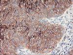 RPN1 Antibody in Immunohistochemistry (Paraffin) (IHC (P))