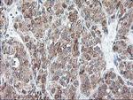 RPN1 Antibody in Immunohistochemistry (Paraffin) (IHC (P))
