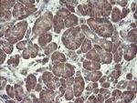 RPN1 Antibody in Immunohistochemistry (Paraffin) (IHC (P))