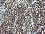 RPN1 Antibody in Immunohistochemistry (Paraffin) (IHC (P))