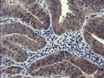 RPN1 Antibody in Immunohistochemistry (Paraffin) (IHC (P))