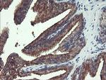RPN1 Antibody in Immunohistochemistry (Paraffin) (IHC (P))
