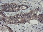 RPN1 Antibody in Immunohistochemistry (Paraffin) (IHC (P))