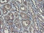 RPN1 Antibody in Immunohistochemistry (Paraffin) (IHC (P))