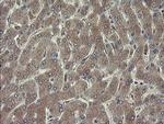 RPN1 Antibody in Immunohistochemistry (Paraffin) (IHC (P))