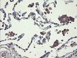 RPN1 Antibody in Immunohistochemistry (Paraffin) (IHC (P))