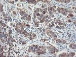 RPN1 Antibody in Immunohistochemistry (Paraffin) (IHC (P))