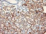 RPN1 Antibody in Immunohistochemistry (Paraffin) (IHC (P))