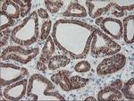 RPN1 Antibody in Immunohistochemistry (Paraffin) (IHC (P))
