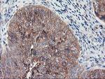 RPN1 Antibody in Immunohistochemistry (Paraffin) (IHC (P))