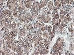 RPN1 Antibody in Immunohistochemistry (Paraffin) (IHC (P))