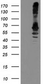 RPN1 Antibody in Western Blot (WB)