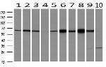 RPN1 Antibody in Western Blot (WB)