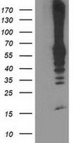 RPN1 Antibody in Western Blot (WB)
