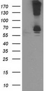 RPN1 Antibody in Western Blot (WB)