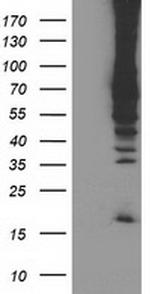 RPN1 Antibody in Western Blot (WB)