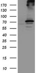 RPN1 Antibody in Western Blot (WB)