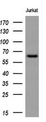RPN1 Antibody in Western Blot (WB)