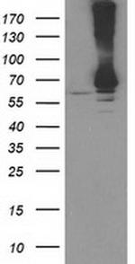 RPN1 Antibody in Western Blot (WB)