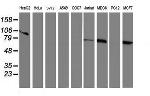 RPN1 Antibody in Western Blot (WB)