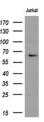 RPN1 Antibody in Western Blot (WB)