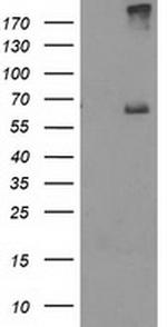 RPN1 Antibody in Western Blot (WB)