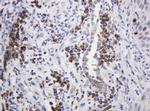 RPN2 Antibody in Immunohistochemistry (Paraffin) (IHC (P))