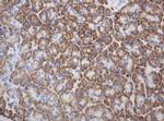 RPN2 Antibody in Immunohistochemistry (Paraffin) (IHC (P))