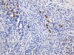 RPN2 Antibody in Immunohistochemistry (Paraffin) (IHC (P))