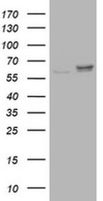 RPN2 Antibody in Western Blot (WB)