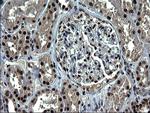 RPRD1B Antibody in Immunohistochemistry (Paraffin) (IHC (P))